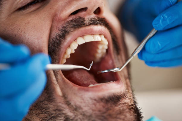 Best Emergency Dental Care for Broken or Chipped Teeth in Needville, TX